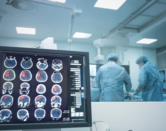 FDA medical device recall, brain surgery
