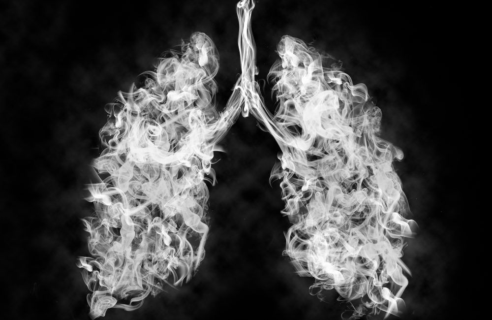 lung injury outbreak, vaping related illness