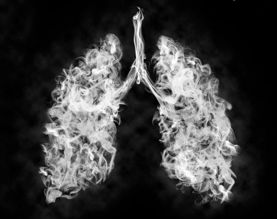 lung injury outbreak, vaping related illness