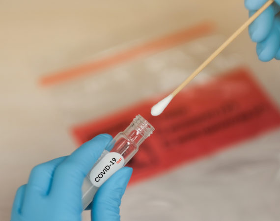 coronavirus test